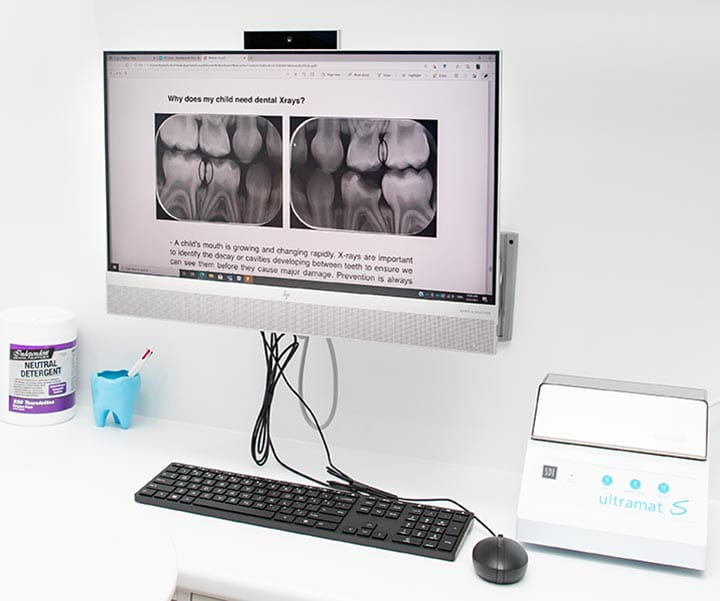 Digital X-rays
